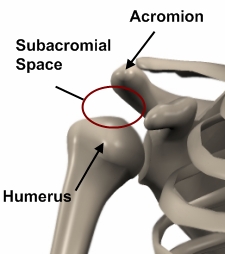 Los Angeles, West Hollywood, Beverly Hills Chiropractor Dr. Nick Campos Subacromial Space