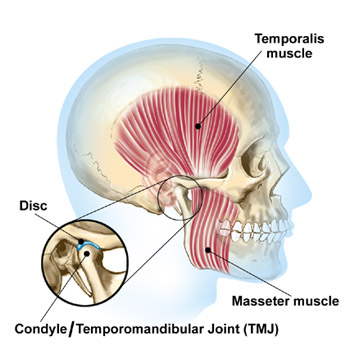 Jaw pain muscles--West Hollywood Chiropractic